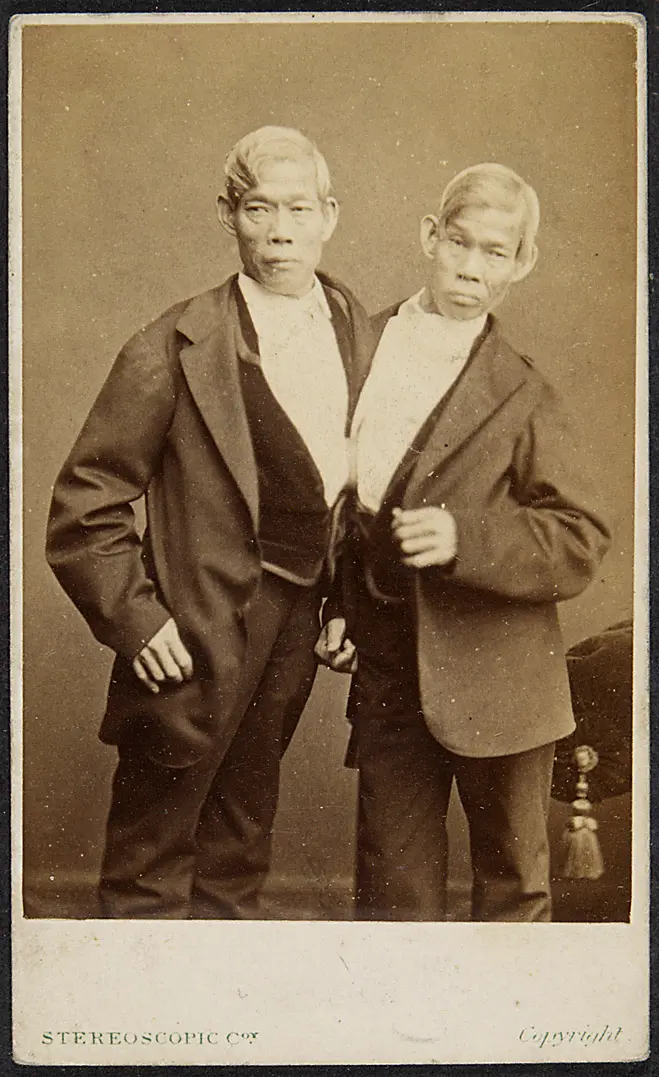 Tschang und Eng
