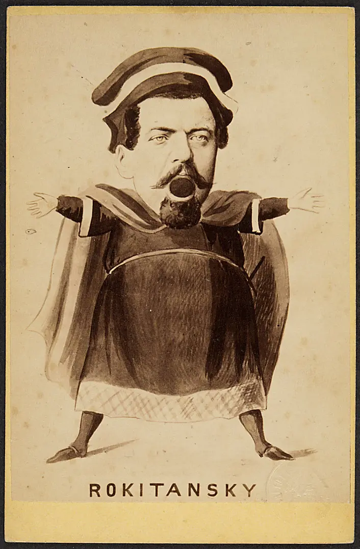 Hans Freiherr von Rokitansky