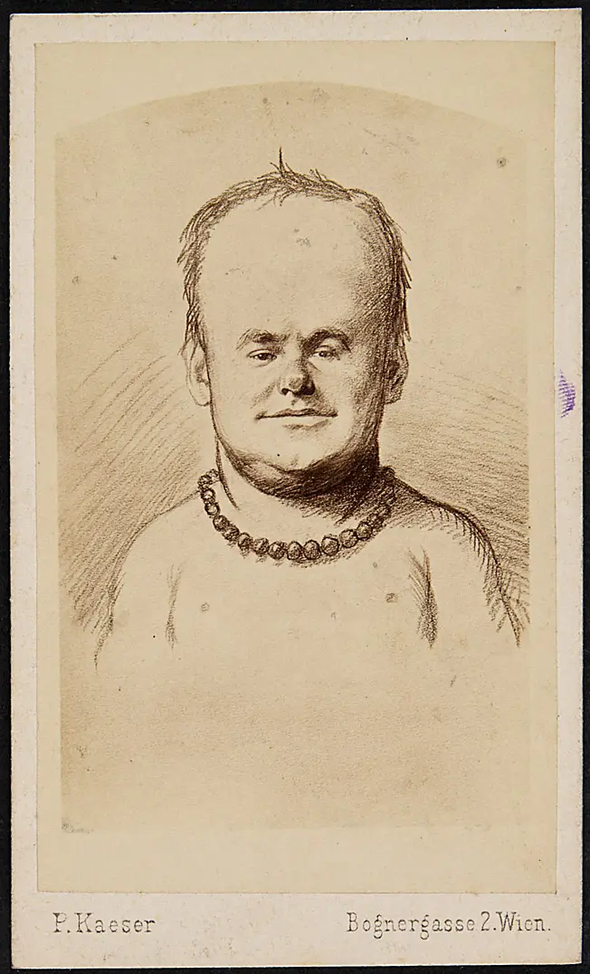 Hermann Schöne