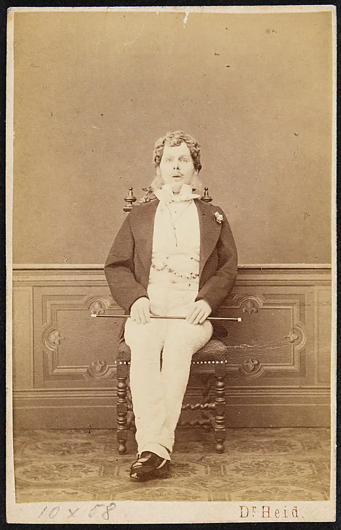 Hermann Schöne